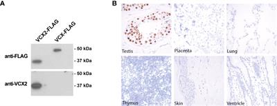 The Cancer/Testis Antigen Gene VCX2 Is Rarely Expressed in Malignancies but Can Be Epigenetically Activated Using DNA Methyltransferase and Histone Deacetylase Inhibitors